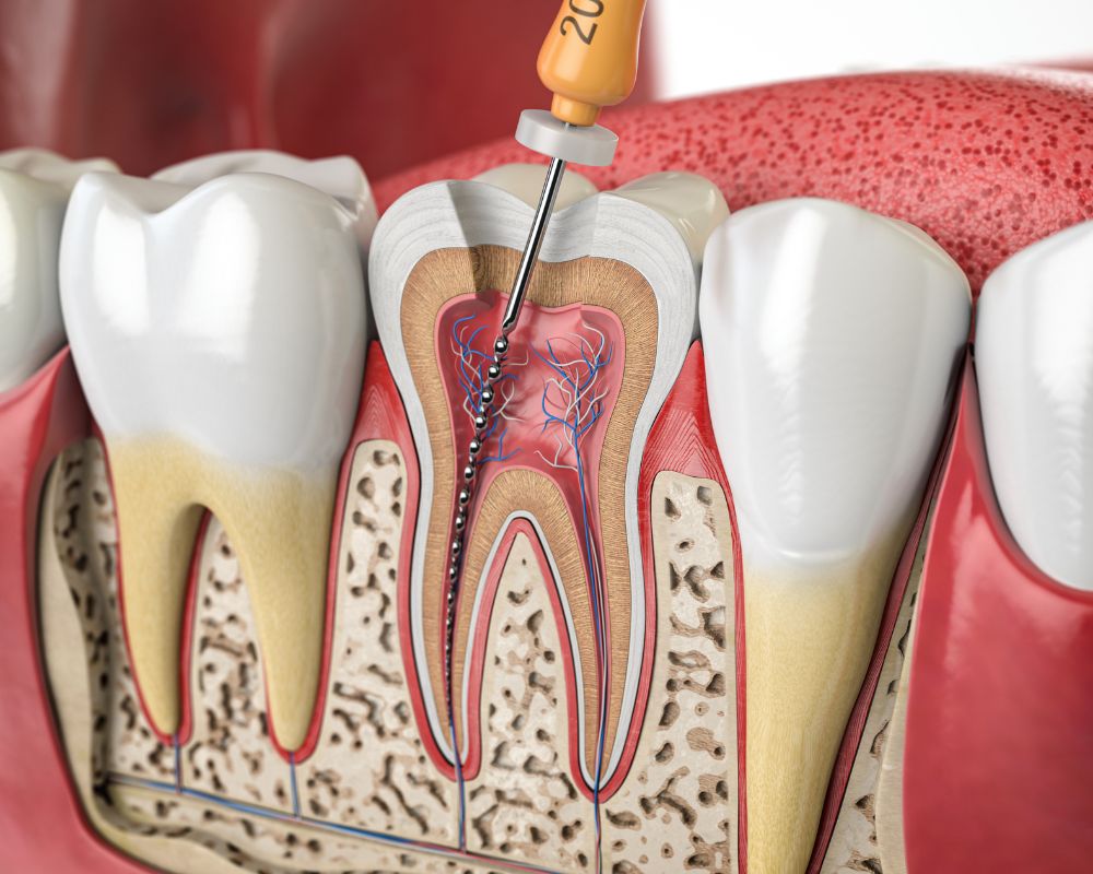 Dr Pichault Aline Oberhausbergen - endodontie